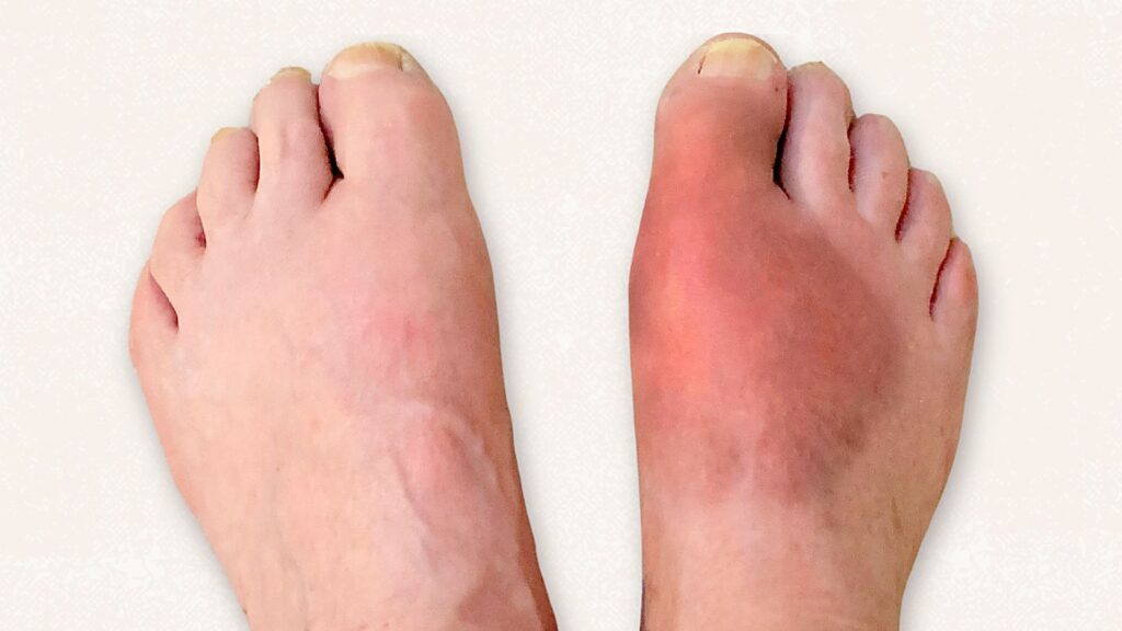 EsfeetCommon Issues Related To Esfeet